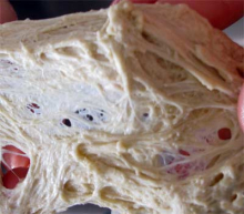 gluten network in dough